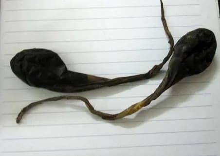 Mật động vật – đởm